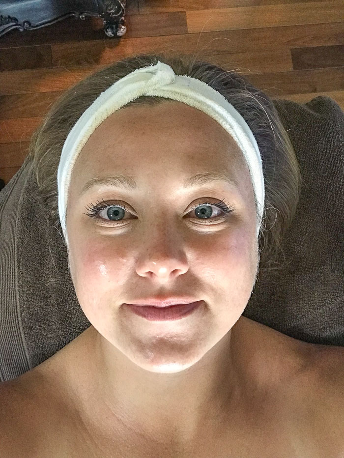 Dermaplaning Skincare at Hall Plastic Surgery and Rejuvenation Center_Natalie Paramore